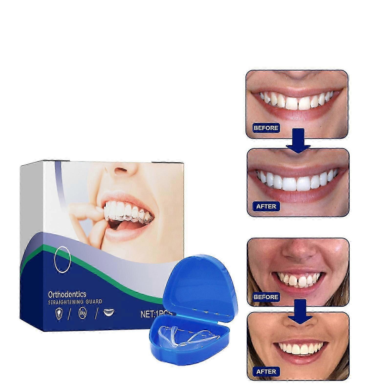 Munskydd för att bita ihop tänder på natten, formbart munskydd för tandgnissling Knipa Bruxism