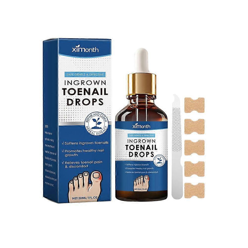 陥入爪の治療。陥入ネイルリペアセラム