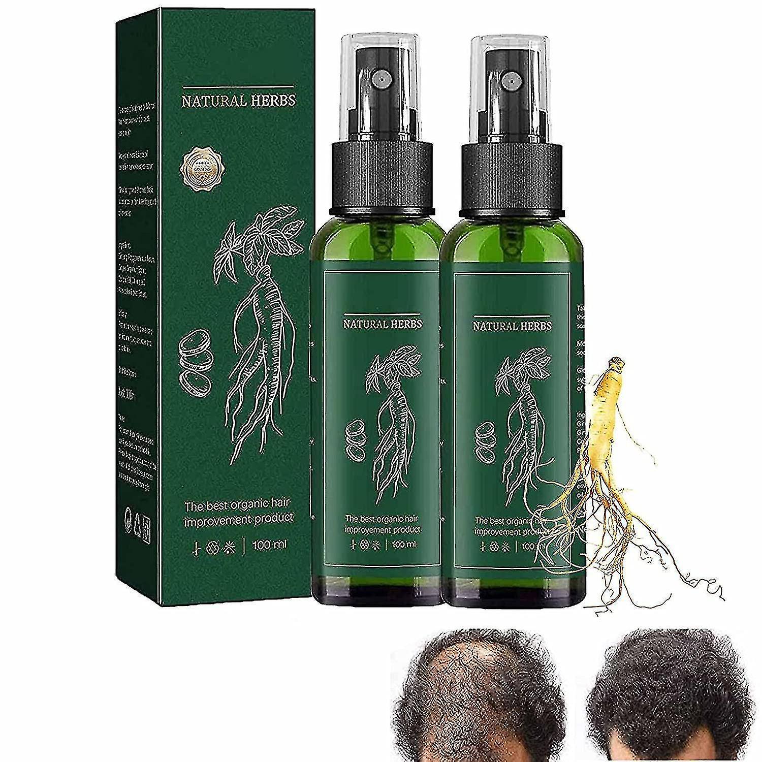 Ginseng Haargroei Essence Spray (2 stuks)