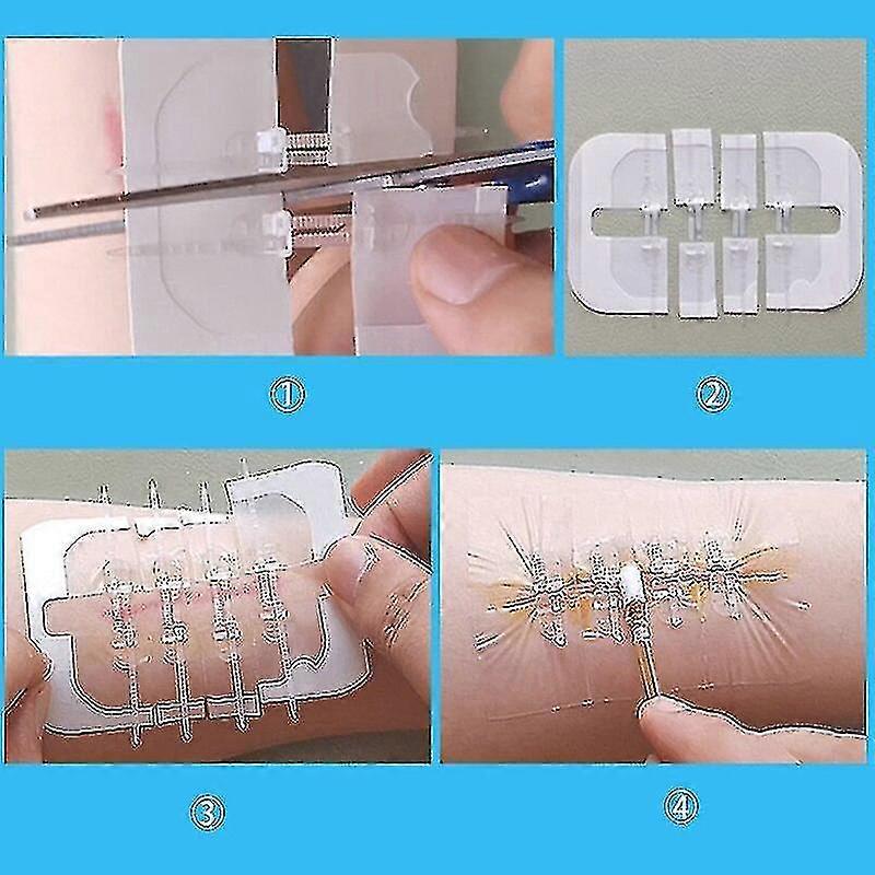 10pcs ジッパータイ創傷閉鎖パッチ止血パッチ創傷高速縫合ジッパーバンドエイド屋外ポータブルスキンケア