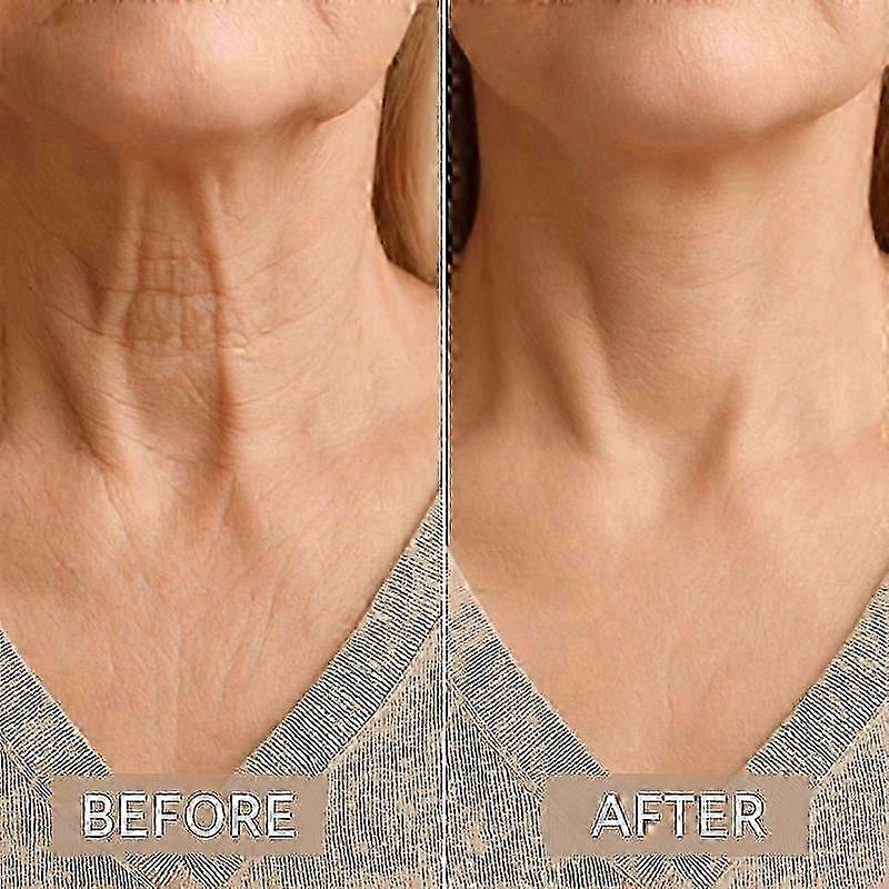 Neck Lift Tape Instant Firming Invisible Anti Wrinkle Patches for Face and Jaw