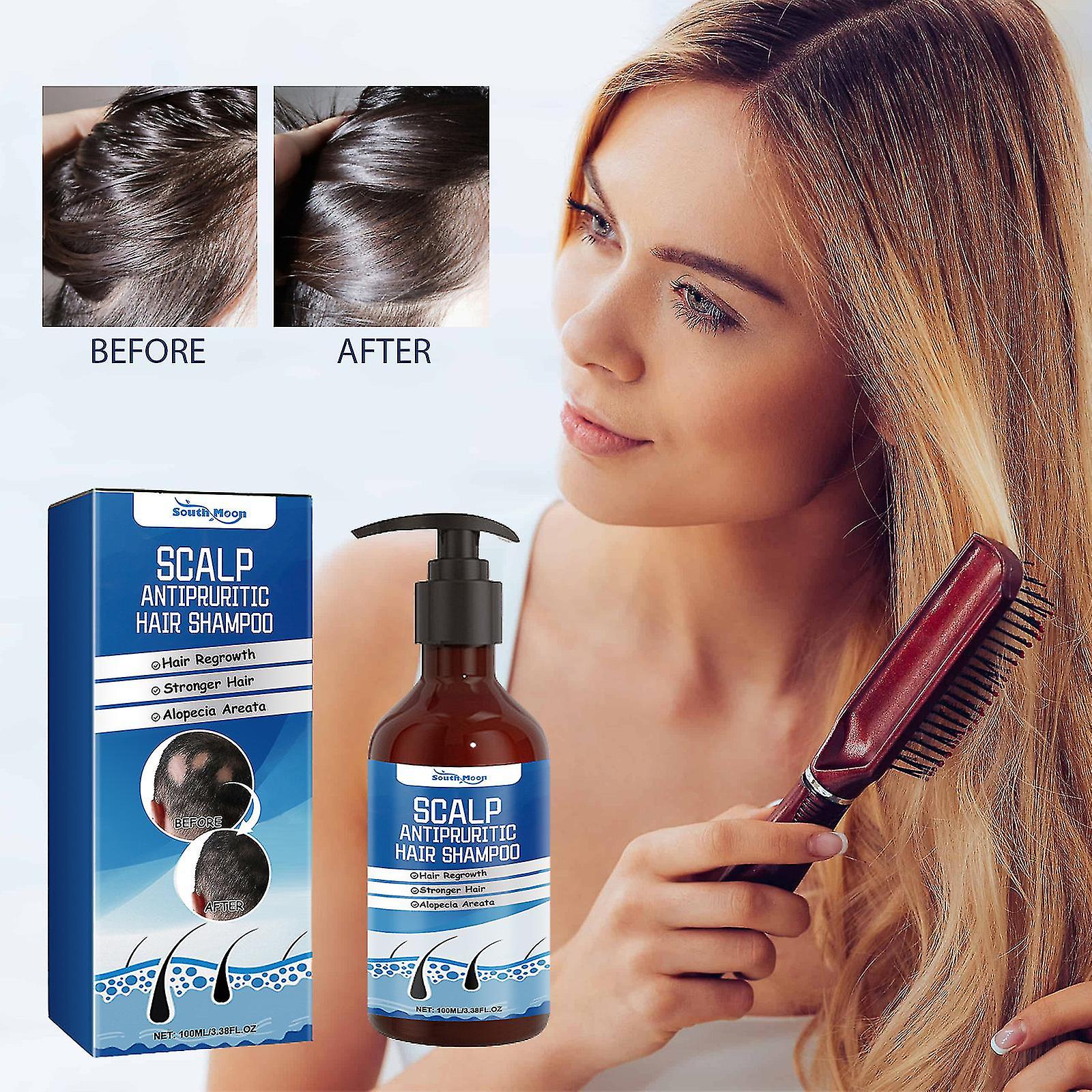 Scalp Anti-Dandruff and Antifungal Shampoo - Treats Folliculitis, Seborrheic Dermatitis