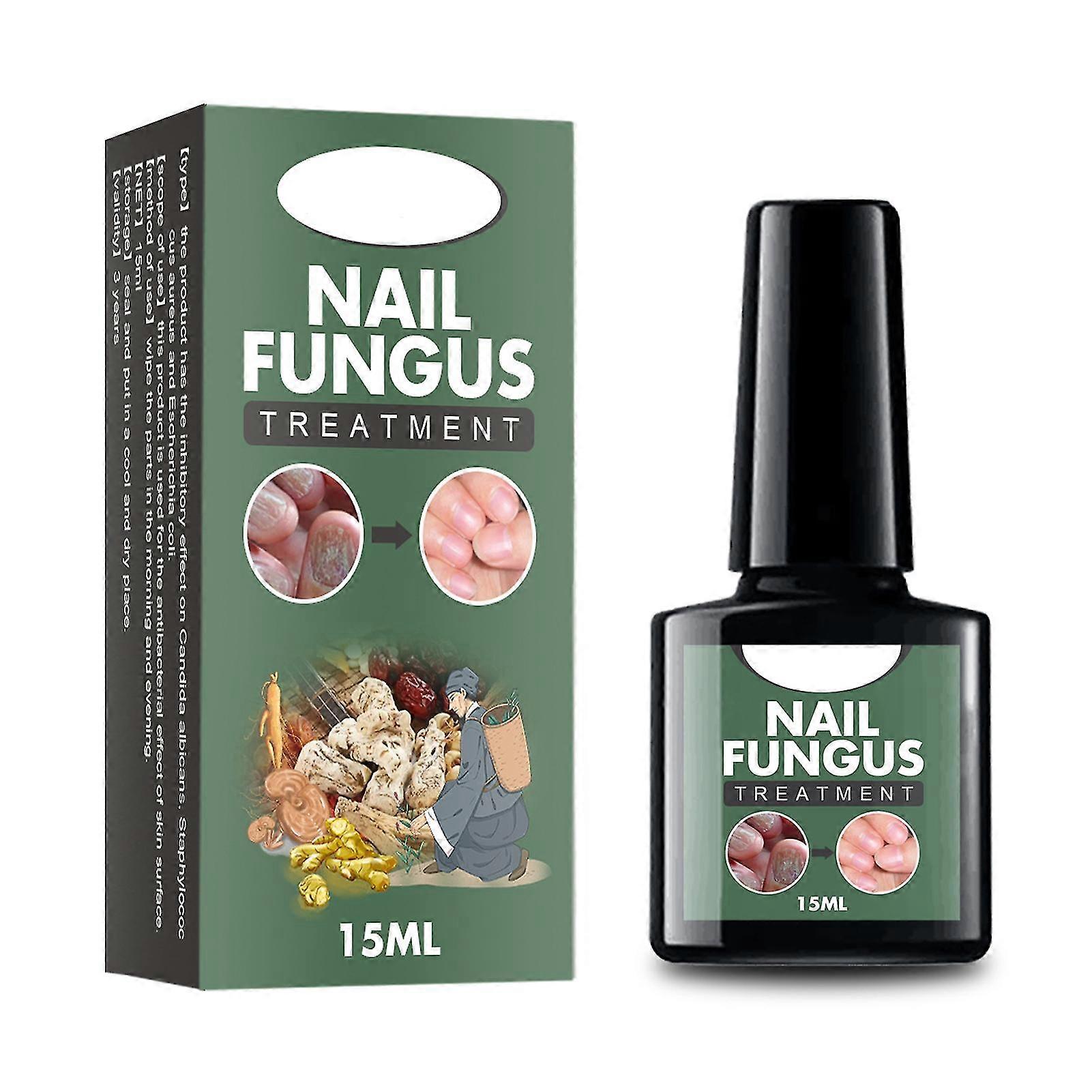 Solution d’ongle gris main pied gris soin des ongles réparation solution d’ongle gris épaississant ongle doux