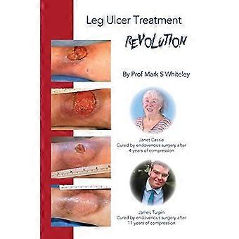 Been ulcer behandeling Revolutie