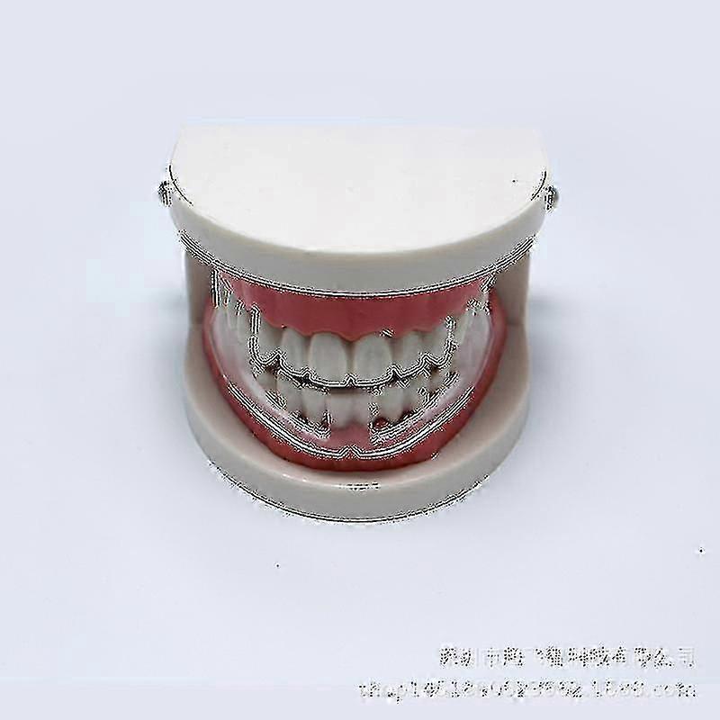 2-Piece Nighttime Teeth Protector