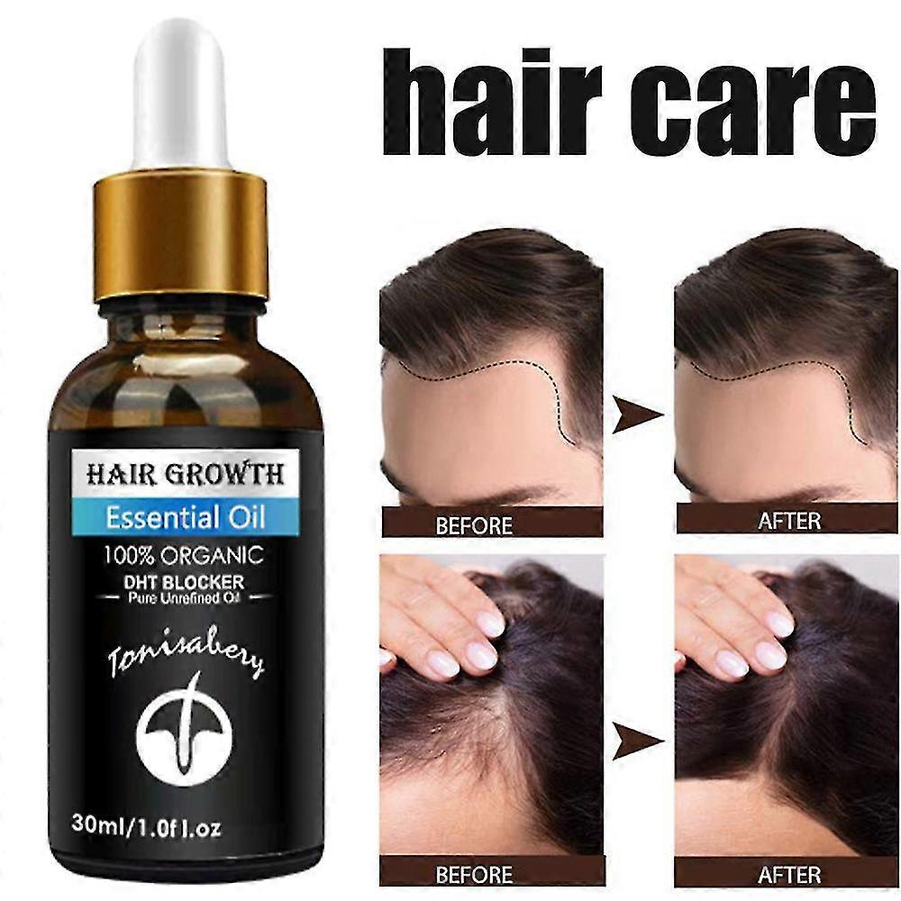 30ml Haargroei Etherische Oliën Haarverzorging