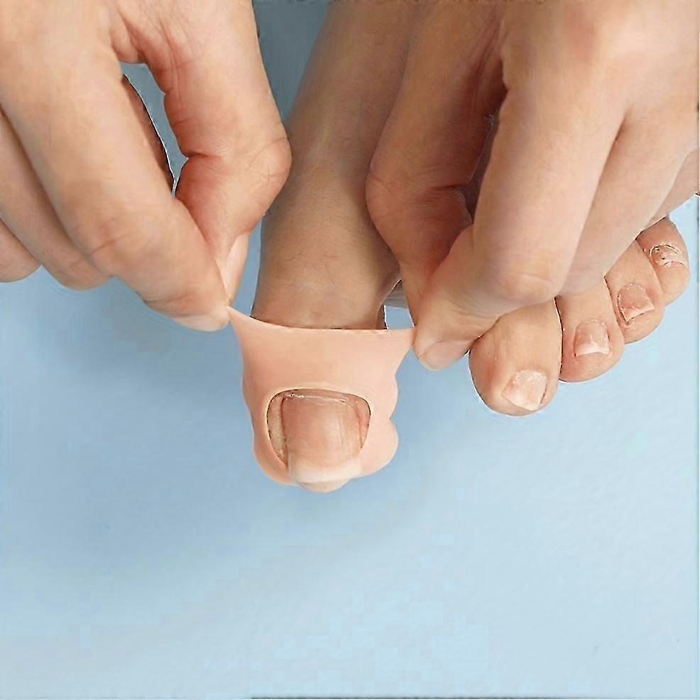 Anti-Wear Ingrown Toenail Protector Cover, Elastic Ingrown Toenail Correction Tool, Ingrown Toenail Corrector Sleeves