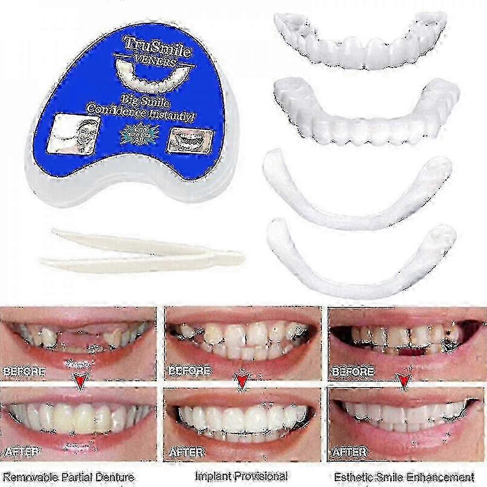w Smile Snap-On False Teeth Upper & Lower Veneers Dentures Cover Set PTW