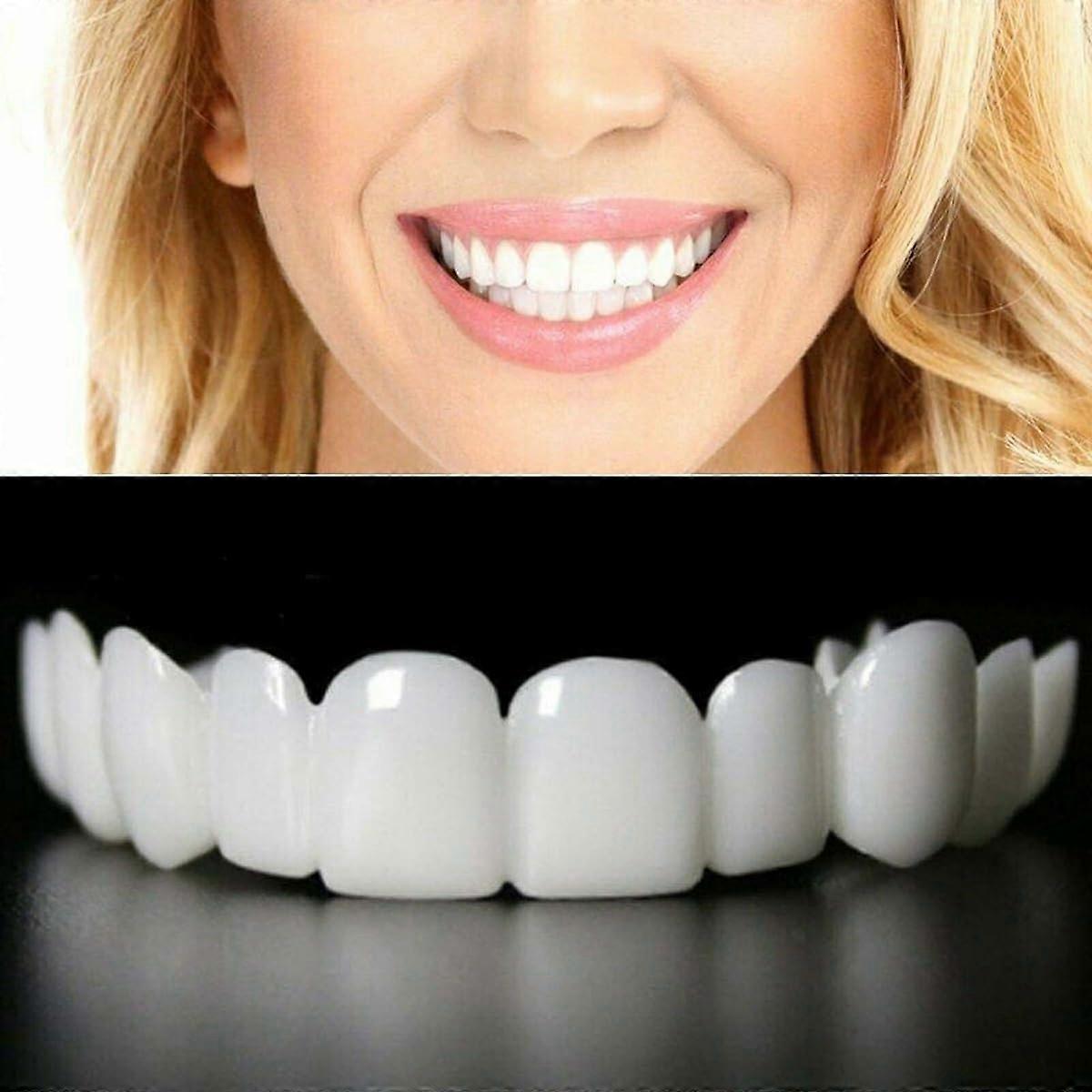 Temporary Veneers Fake Teeth Kit for Missing Teeth Upper Lower Set SnapOn Instant Smile