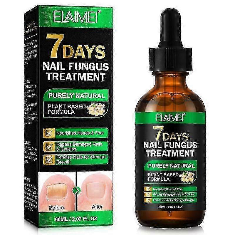 Behandeling van schimmelnagels - Extra sterke behandeling van schimmelnagels voor teennagels en nagels