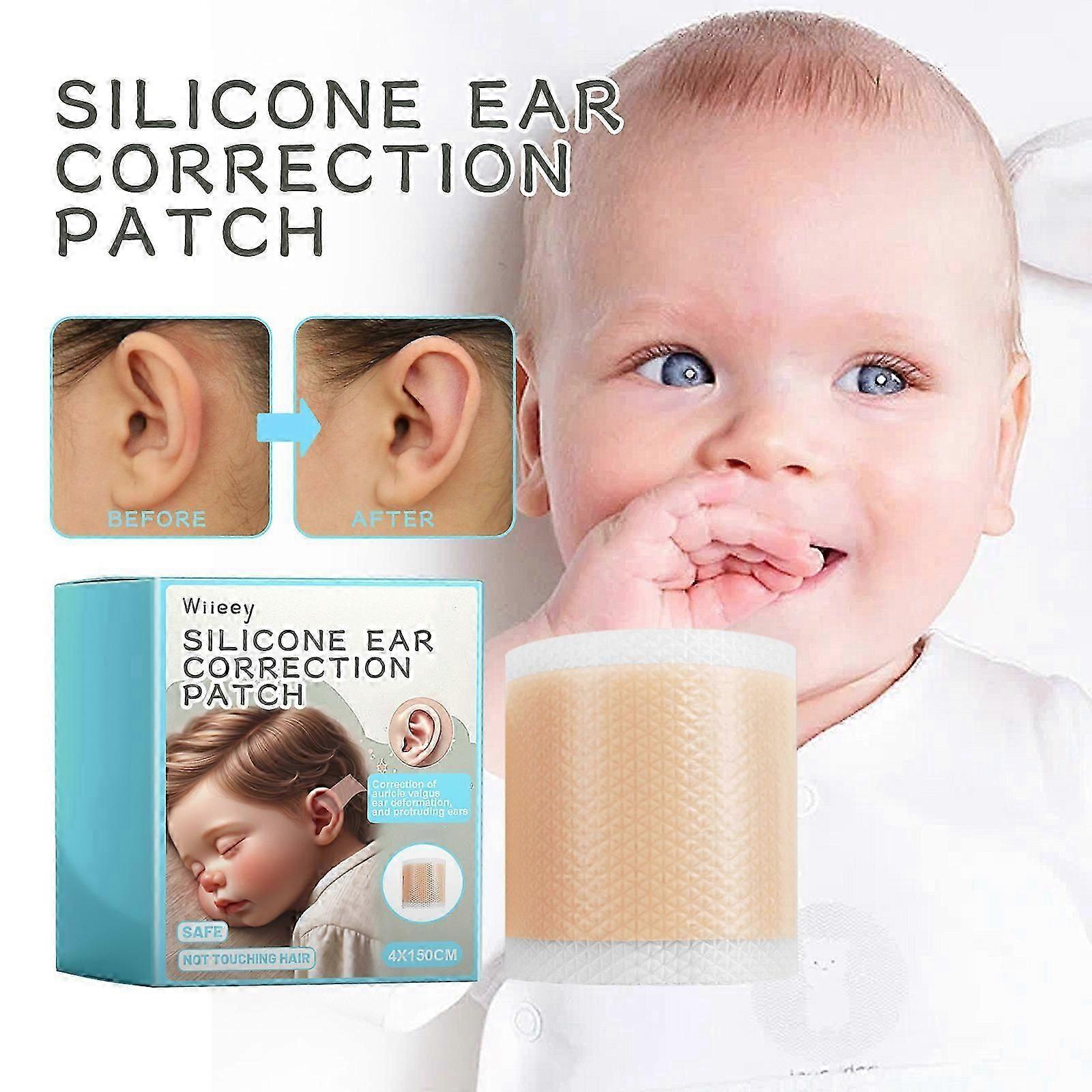 Baby moale respirabil silicon ureche corectoare bandă, auriculă pentru copii Valgus corecție patch-uri corectoare estetice ureche pentru copil sugar baby ureche corecție