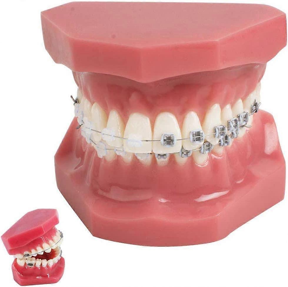 Orthodontic Teeth Model with Ceramic and Metal Brackets, Dual Bracket Comparison for Teaching