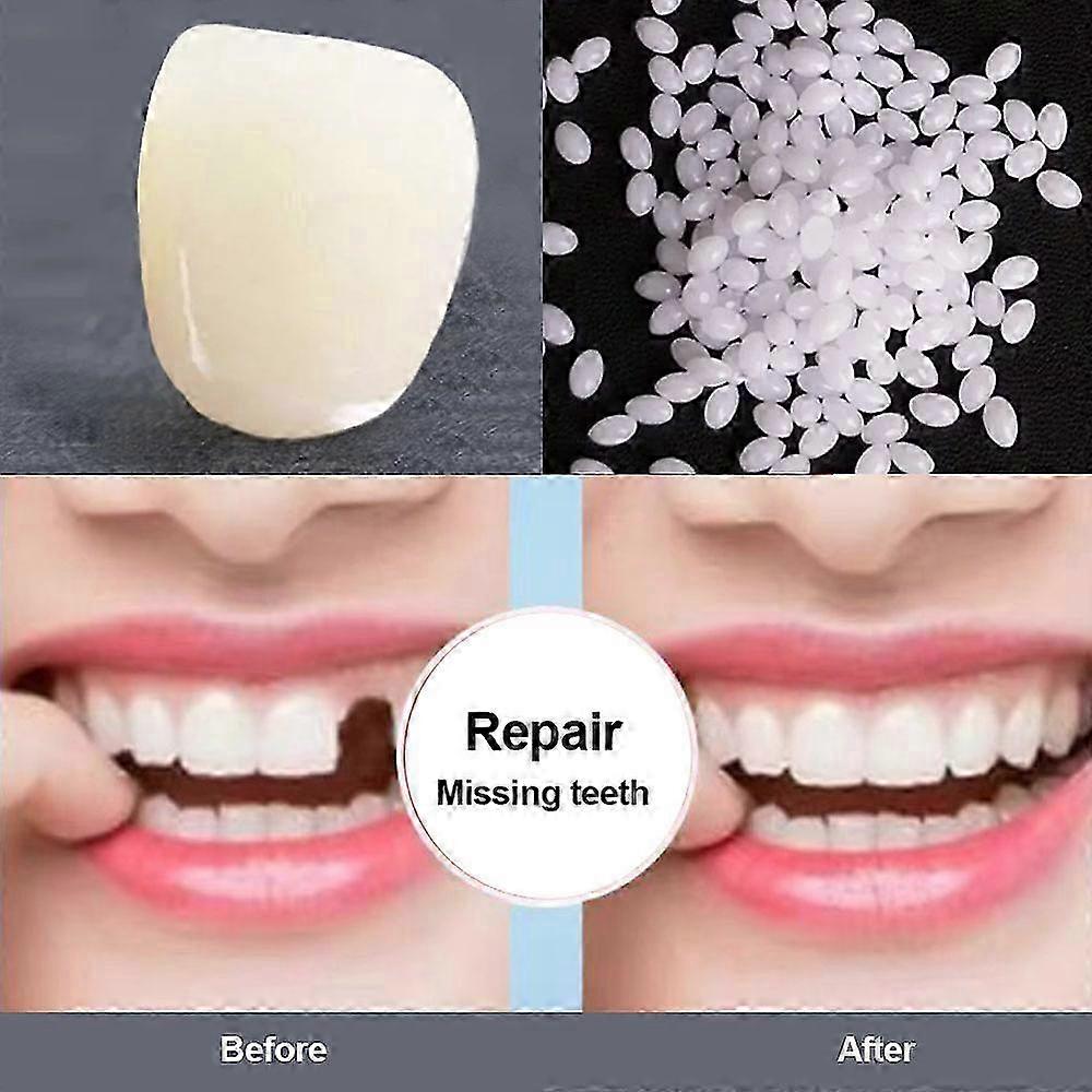 Resin Tooth Permanent high hardness Repair Glue Shapeable Teeth Gaps Filling Teeth Repair Falseteeth Glue Safety Dental Supplies NL