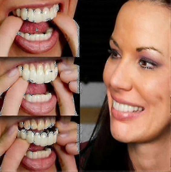 Conjunto de Dentadura Superior e Inferior de Alta Qualidade - Sorriso Instantâneo com Design de Ajuste Confortável