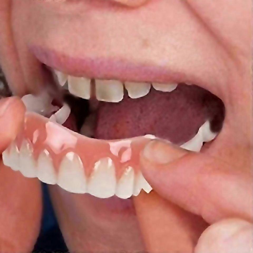 For Extra Thin Fake Bright Tooth Veneers Silicone Soft Safe Adhesive Denture Hide Shade Braces Comfo