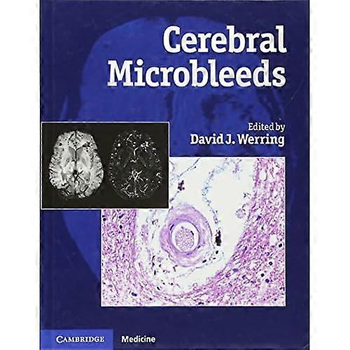 Cerebral Microbleeds: Pathophysiology to Clinical Practice