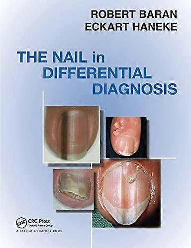 Nail in Differential Diagnosis