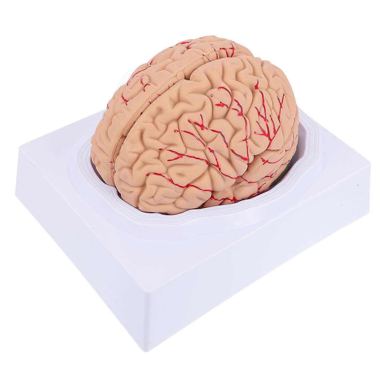 Brain Vessel Model For Study Of Human Cerebrovascular Anatomy Demonstration 8.1X6.9X5.9In 1Pack