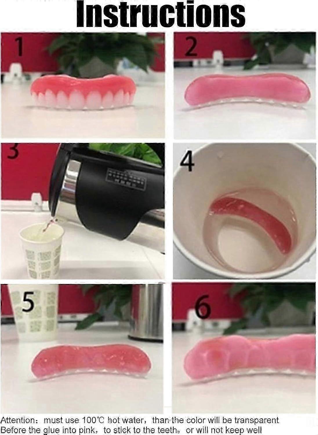 Silicone Temporary Smile Veneers