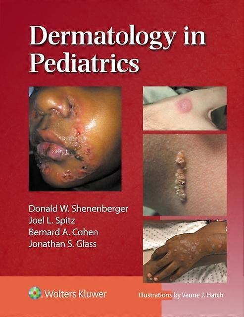 Dermatology In Pediatrics by JOEL L. SPITZ Paperback Book