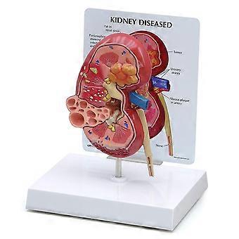 Pathologien Anatomie Von Erkrankten Für Bildungswerkzeug Gpi Anatomicals