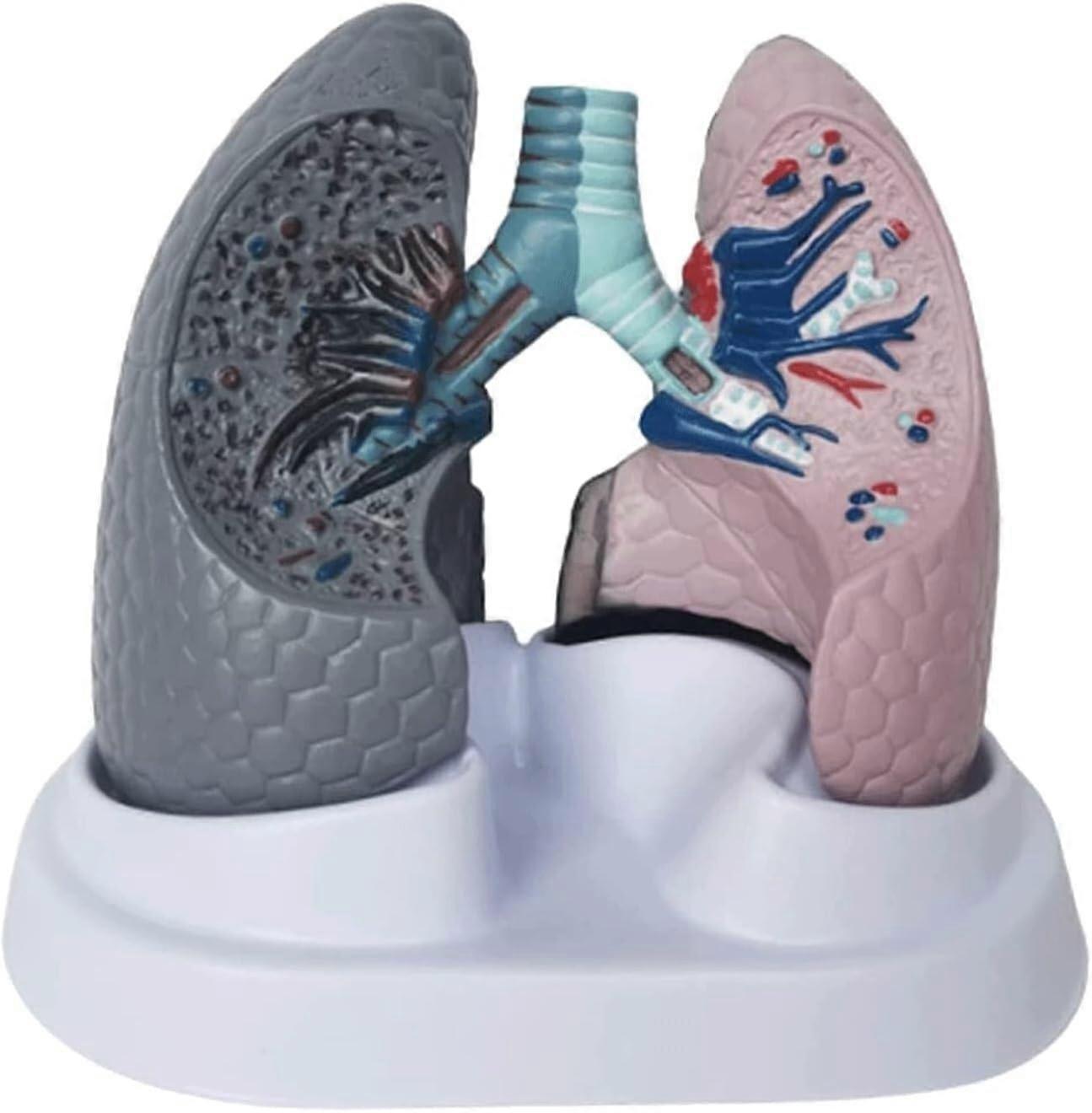 Smoking and Normal Lung Anatomy Model with Base for Classroom Teaching