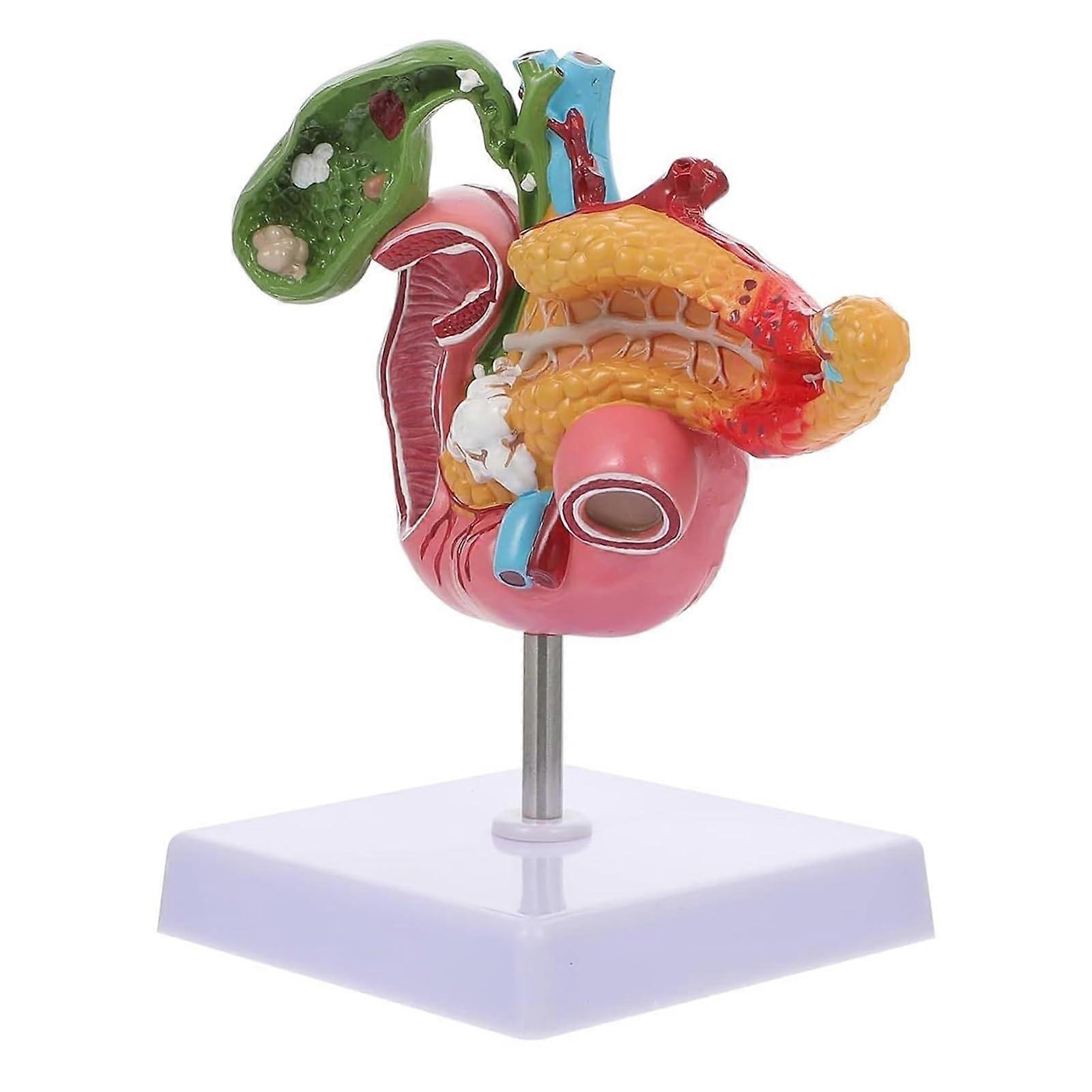 Anatomical Pancreas Model LifeSize Digestive System Educational PVC Pathology Teaching Aid