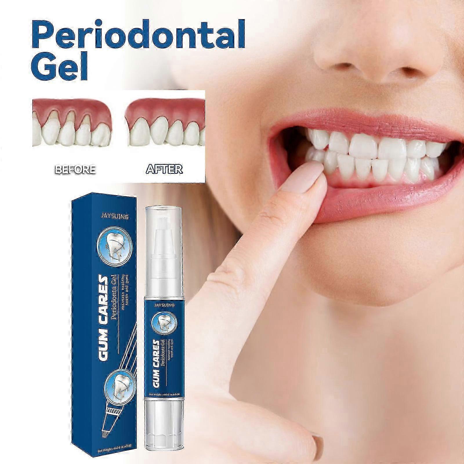 Jaysuingガムケアジェルディープクレンジング歯の汚れ、歯石、腫れて痛みを伴うガムクレンジングジェルBF