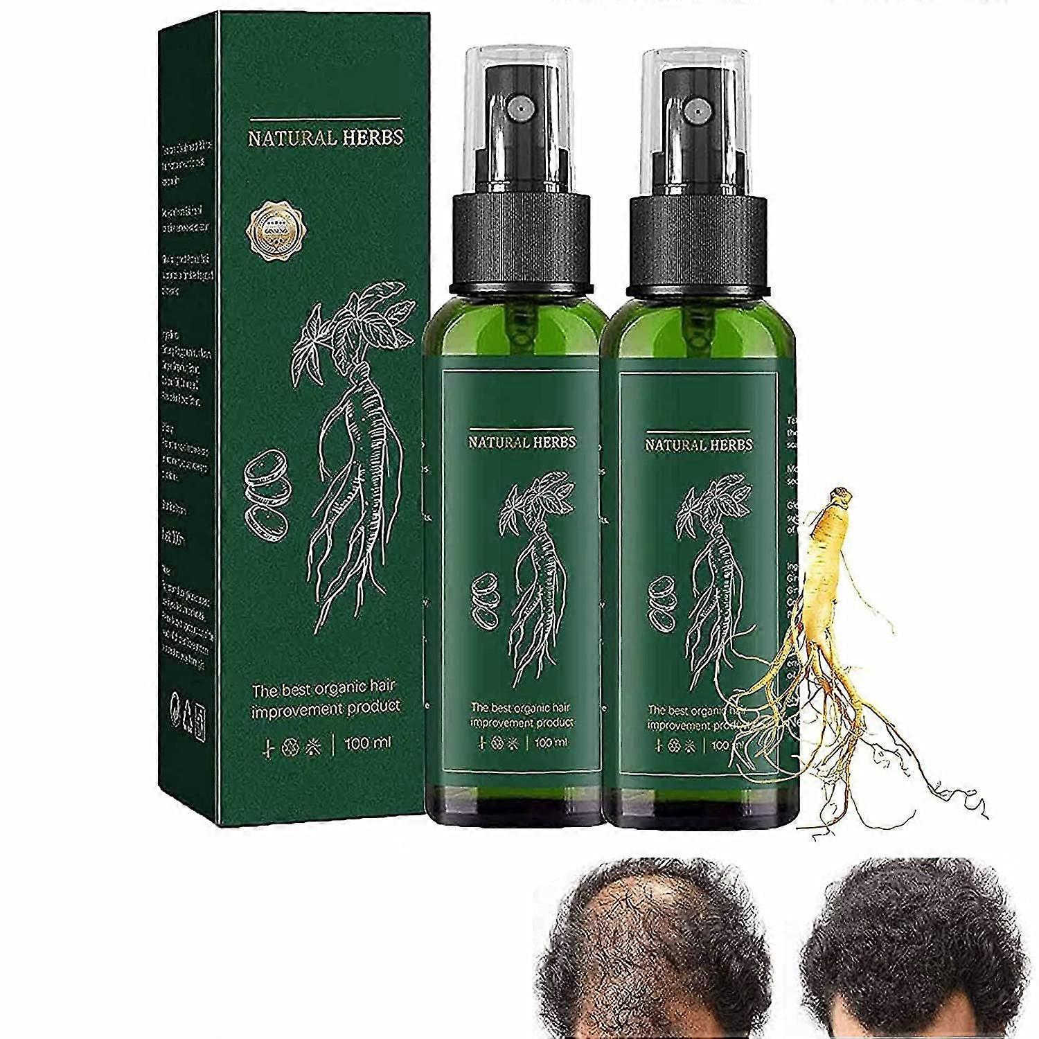 2cs Ginseng Haarregenerationsspray, Ginseng Haarwuchs Essenz, Ginseng Haarwuchs Spray