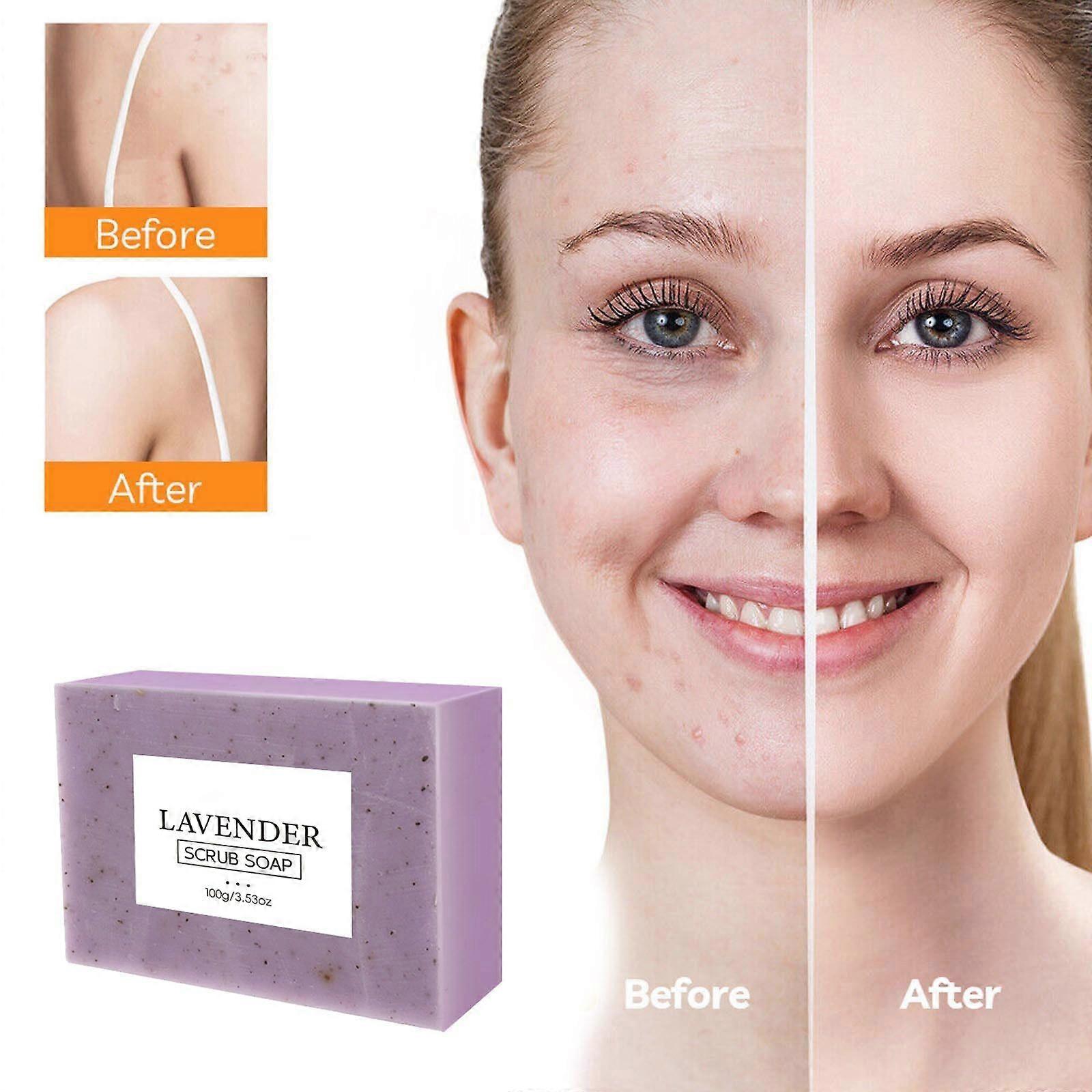 Zeep, Citroen, Kurkuma, Zeep, Zeep, Reiniging, Kurkuma, Zeep, Gelaats- en Lichaamsdouchezeep, Versteviging Poriën En Verwijdering Van Pigmenten, 100 g FYLE8541