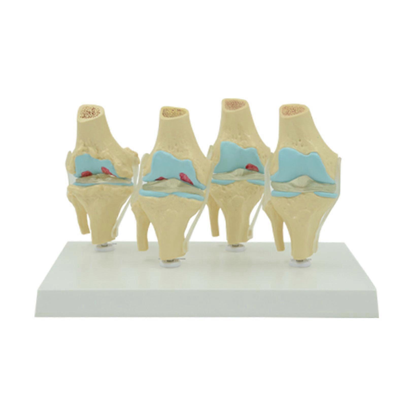 Realistic Knee Joint Model with Display Base for Doctors Office Medical School