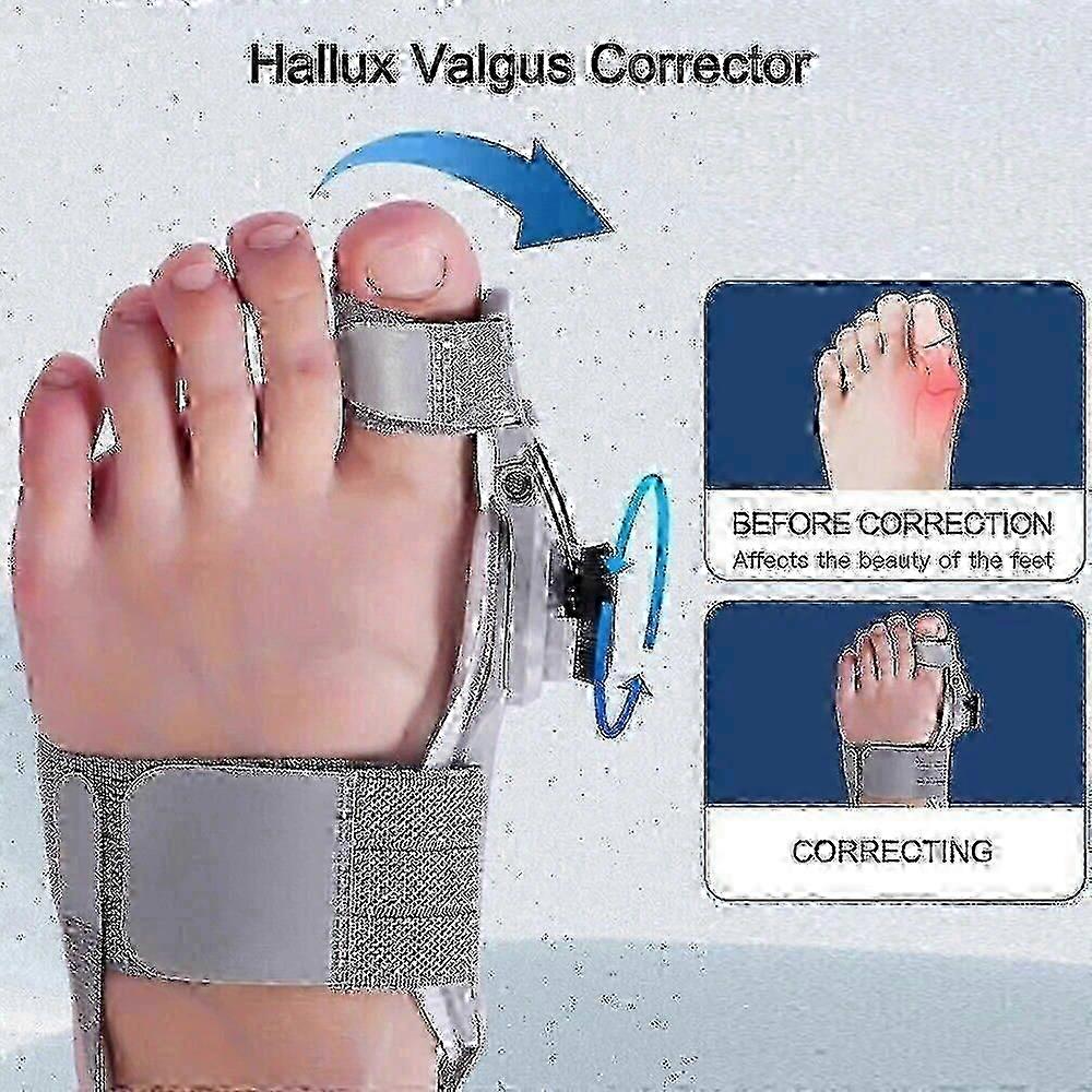 Treatmedy Bunion Fix Toe Valgus Corrector