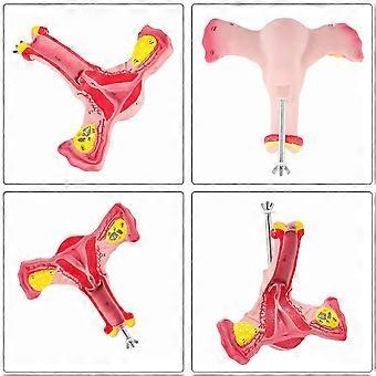 1:1 Human Female Uterus Ovary Fallopian Tubes Model Anatomical Human ...