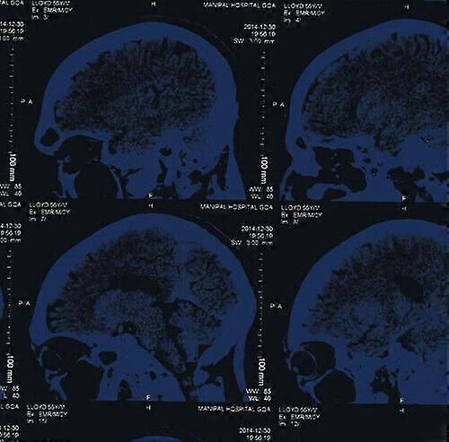 The Nightingales Mind Over Matter CD (2015) NEW