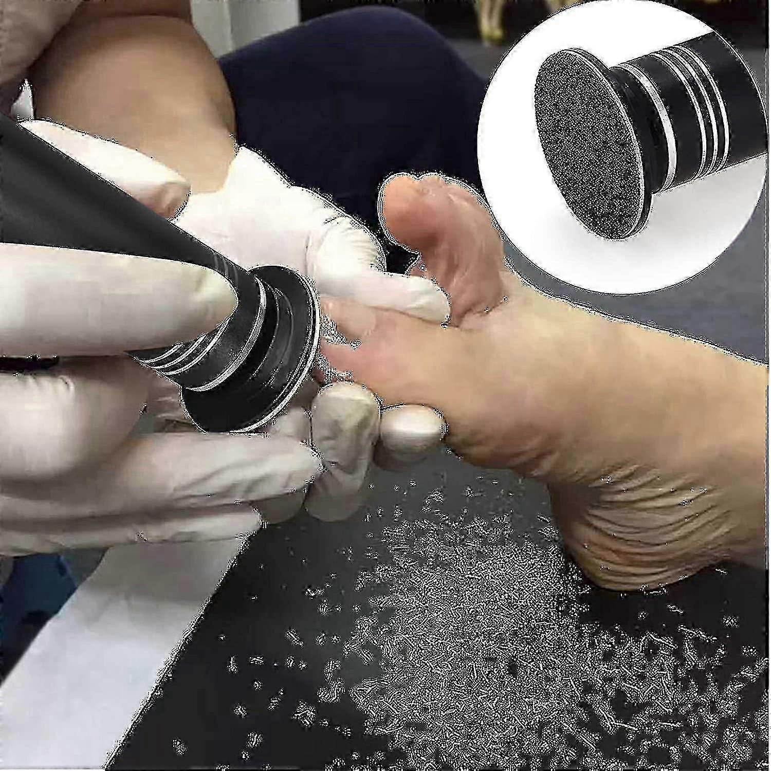 ترقية مزيل الكالس الكهربائي (سرعة قابل للتعديل) مع 60pcs أقراص الصنفرة المتوافقة ، المهنية باديكير القدم ملف ساندر للرجال النساء الميتات