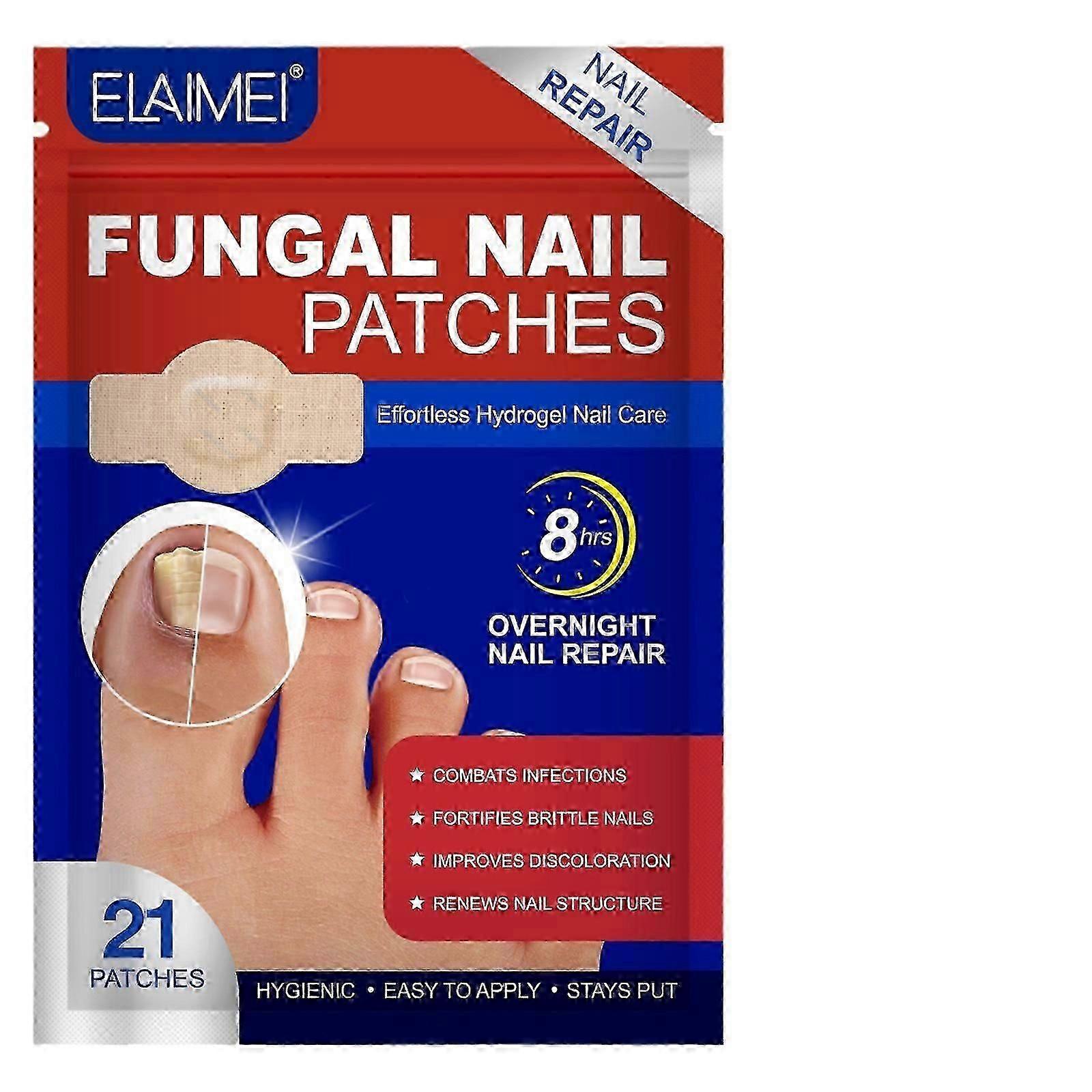 Patchs réparateurs d’ongles pour la correction incarnée et le traitement des champignons
