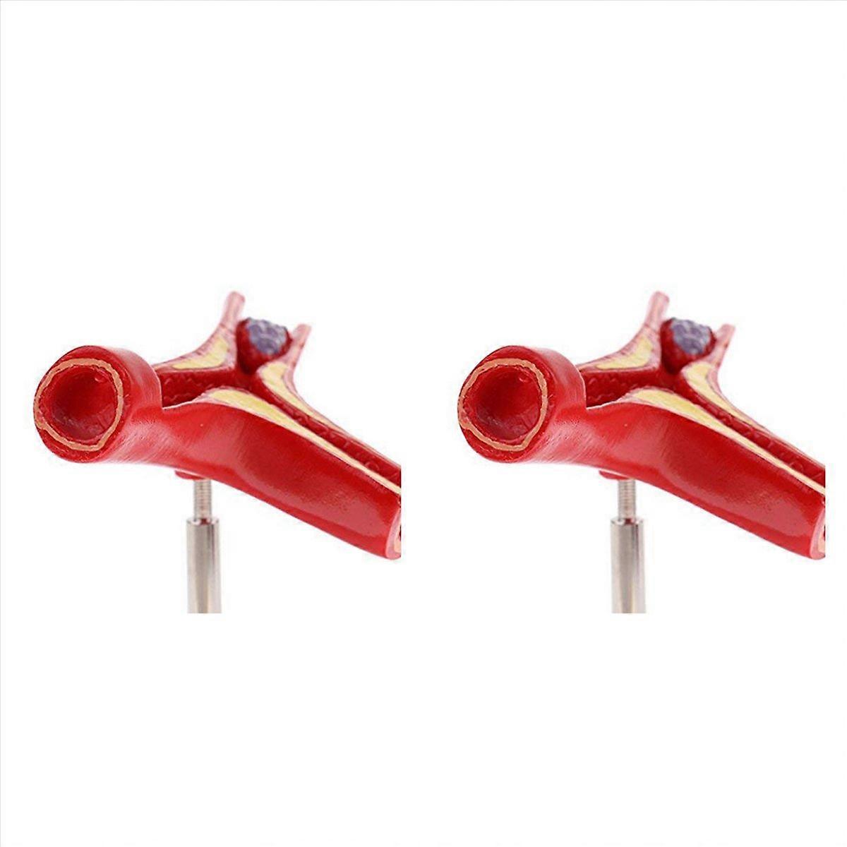 Human Atherosclerosis Cardiovascular Model