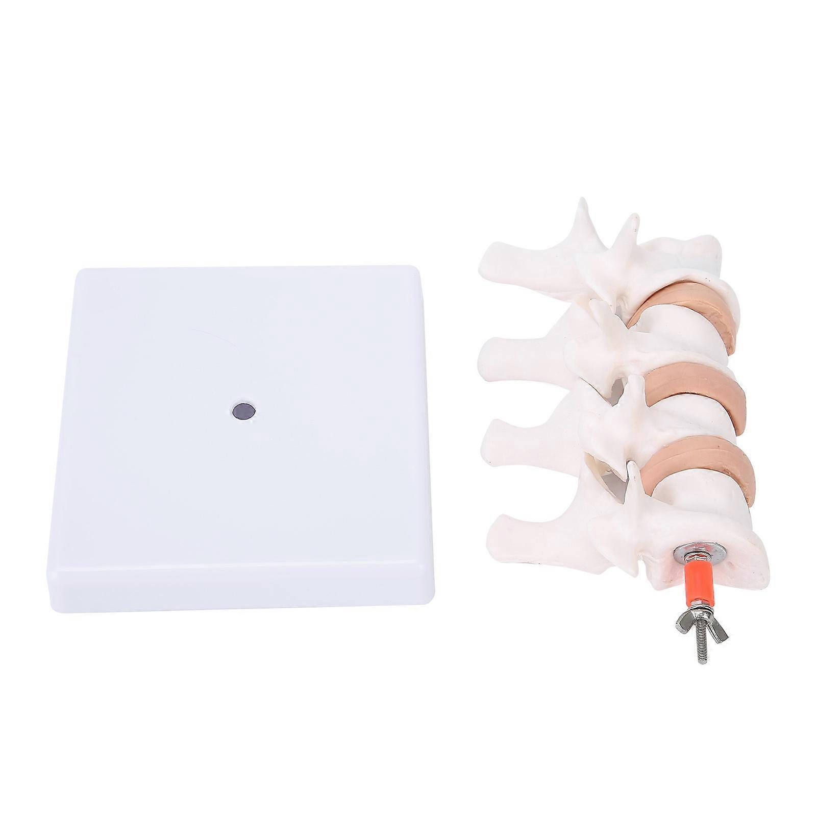 Osteoporosis Model Human Anatomical Spine Model for Teaching and Demonstration