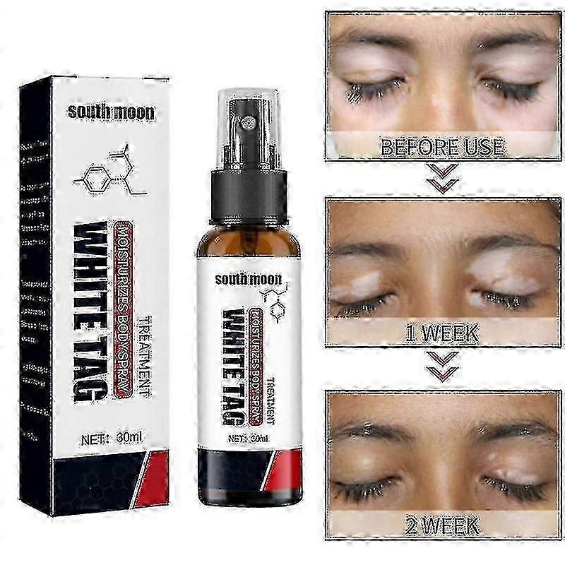 3 x South Moon Vitiligo behandlingsspray