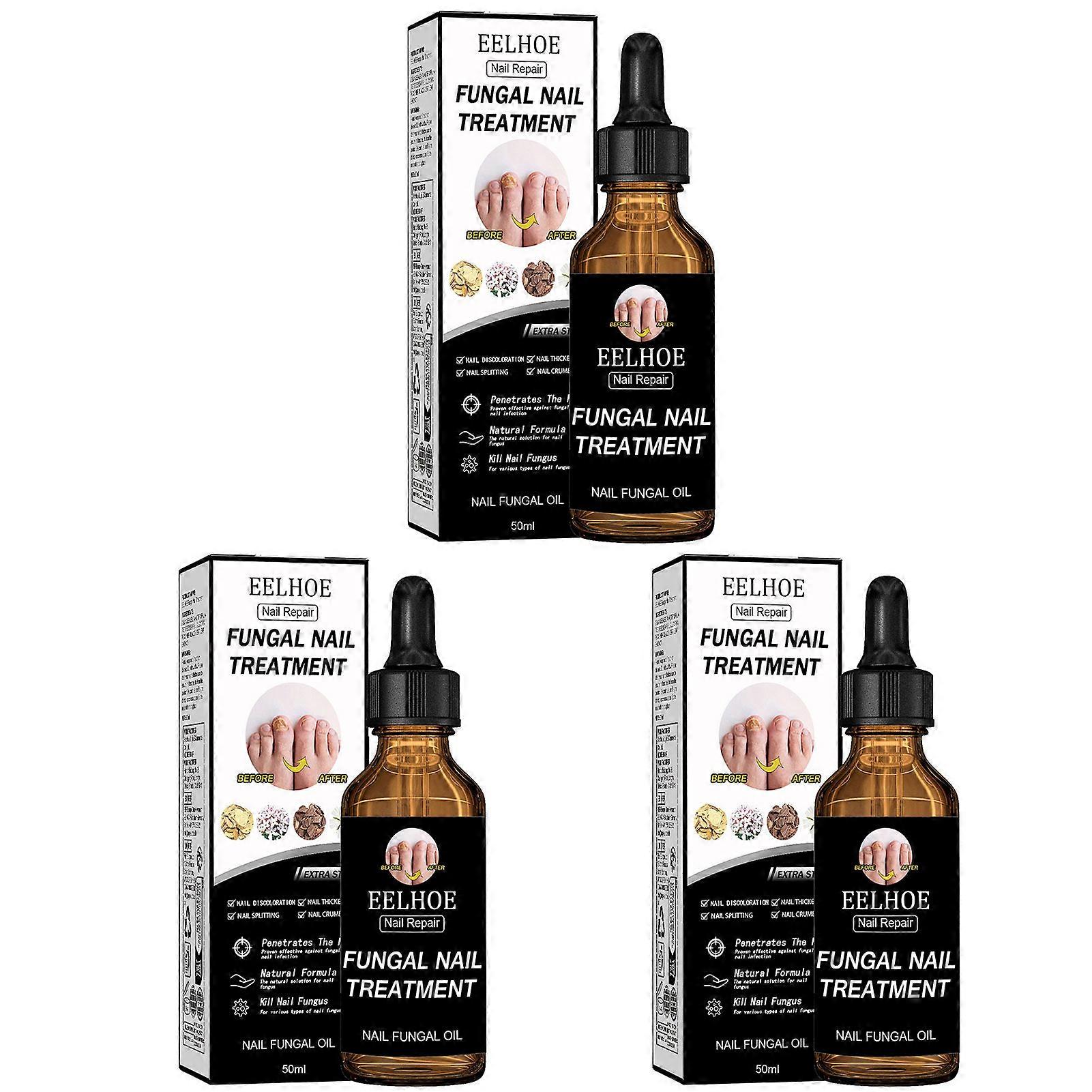 Nail Repair Serum - Fast & Effective Solution for Brittle, Discolored, and Damaged Nails, Promotes Healthy Growth & Shiny Finish