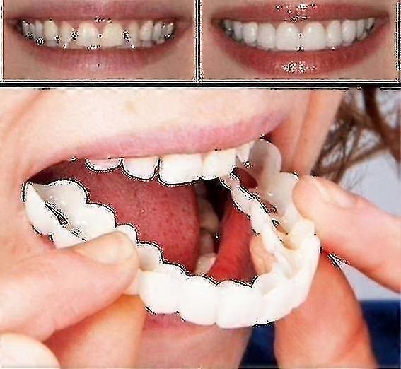 A Pair Upper & Lower High Quality Denture Instant Smile Comfort Fit Flex Co