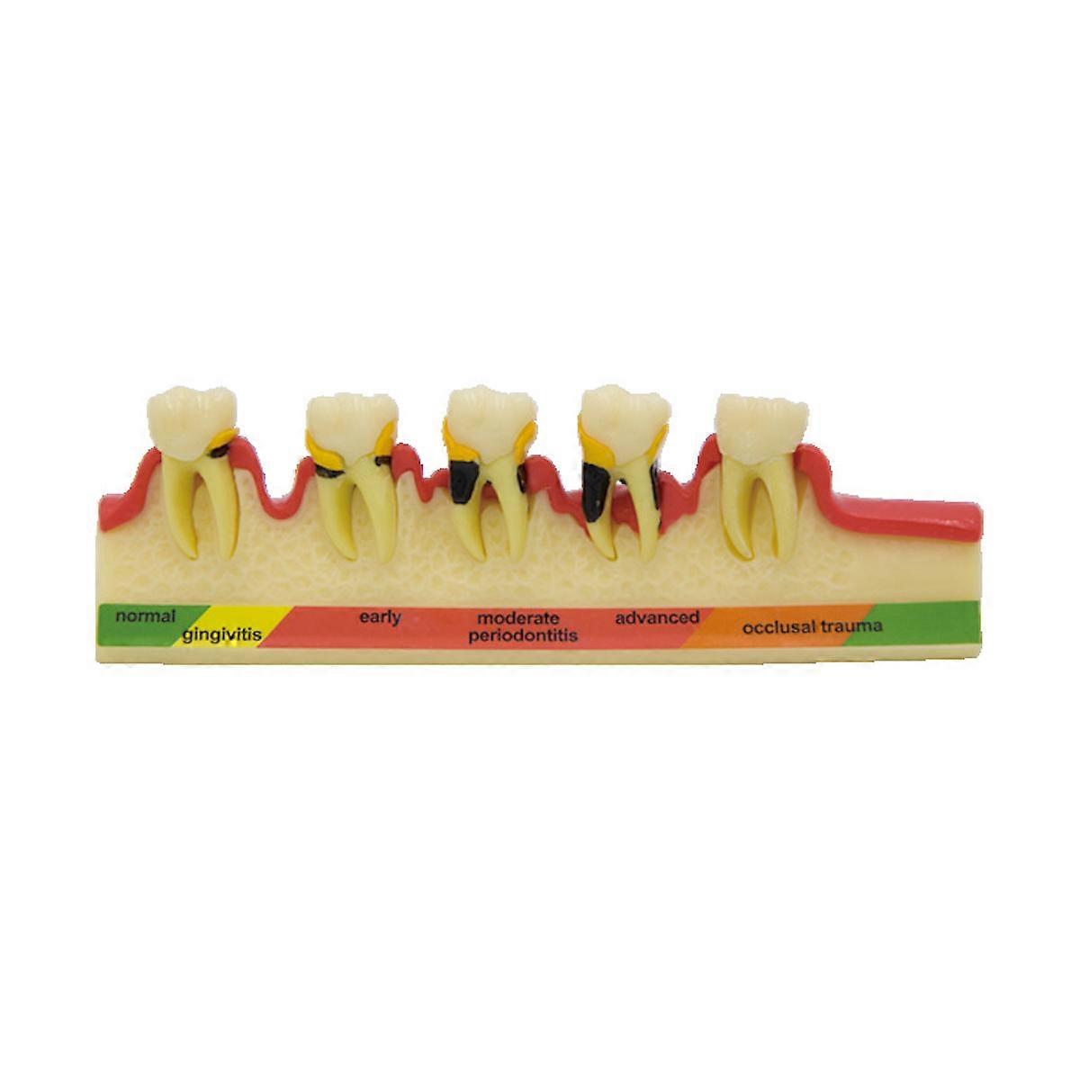 Oral Model Medical Teaching Model Tooth Peripheral Classification Model (Soft Gum)