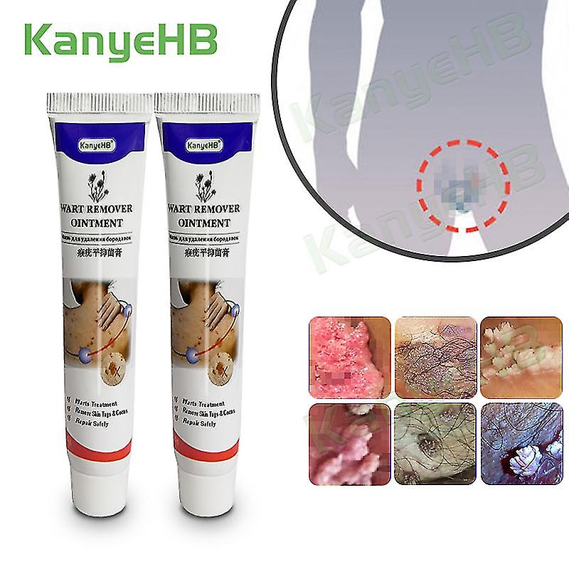 New Arrivals Wart Removal Ointment Genitals Wart Treatment Cream Neck