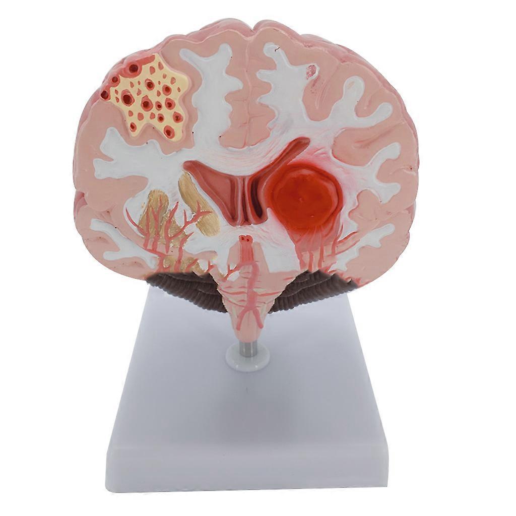 Human Brain Model with Cerebral Cortex Brain Stem Arteries Etc for Education