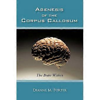 Agenesie des Corpus Callosum