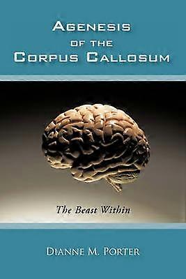 Agenesi av Corpus Callosum