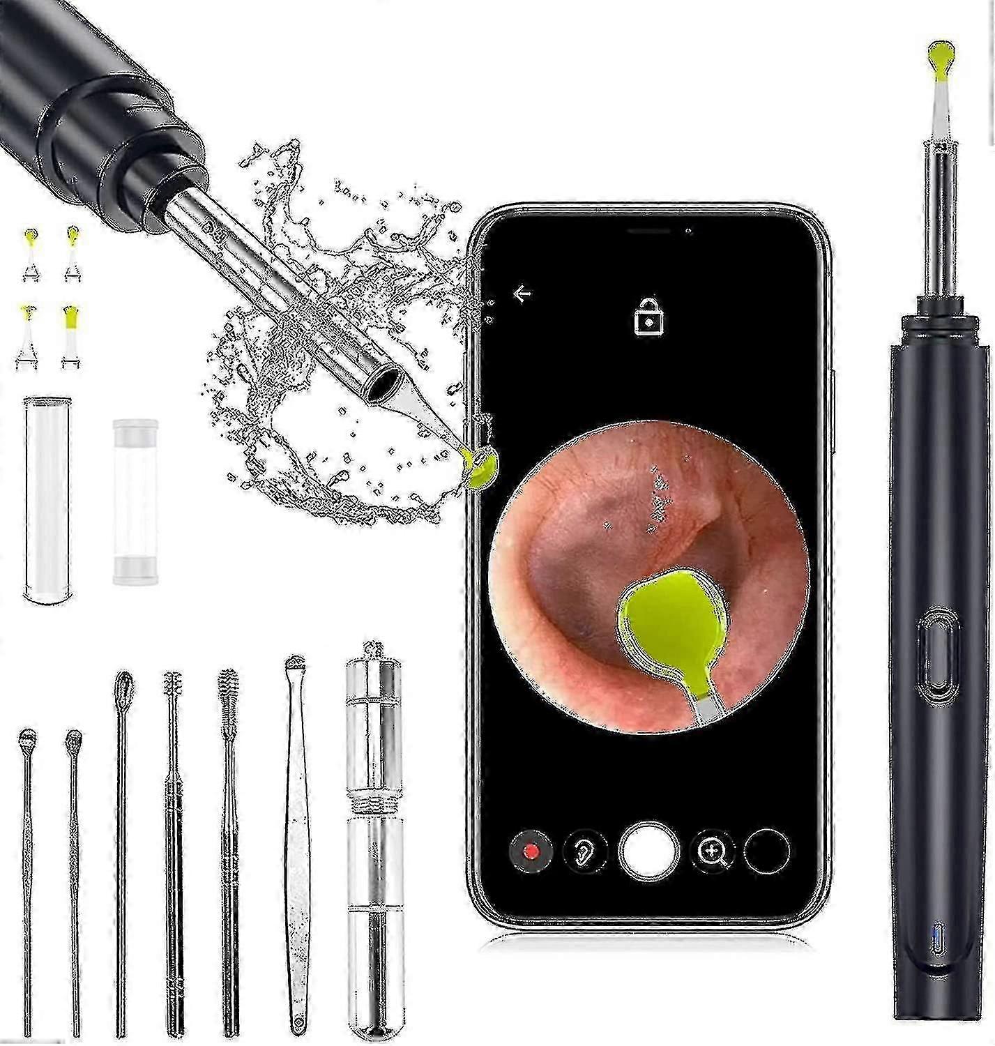 Wireless Earwax Removal Kit with Camera and LED Light - Safe for All Ages