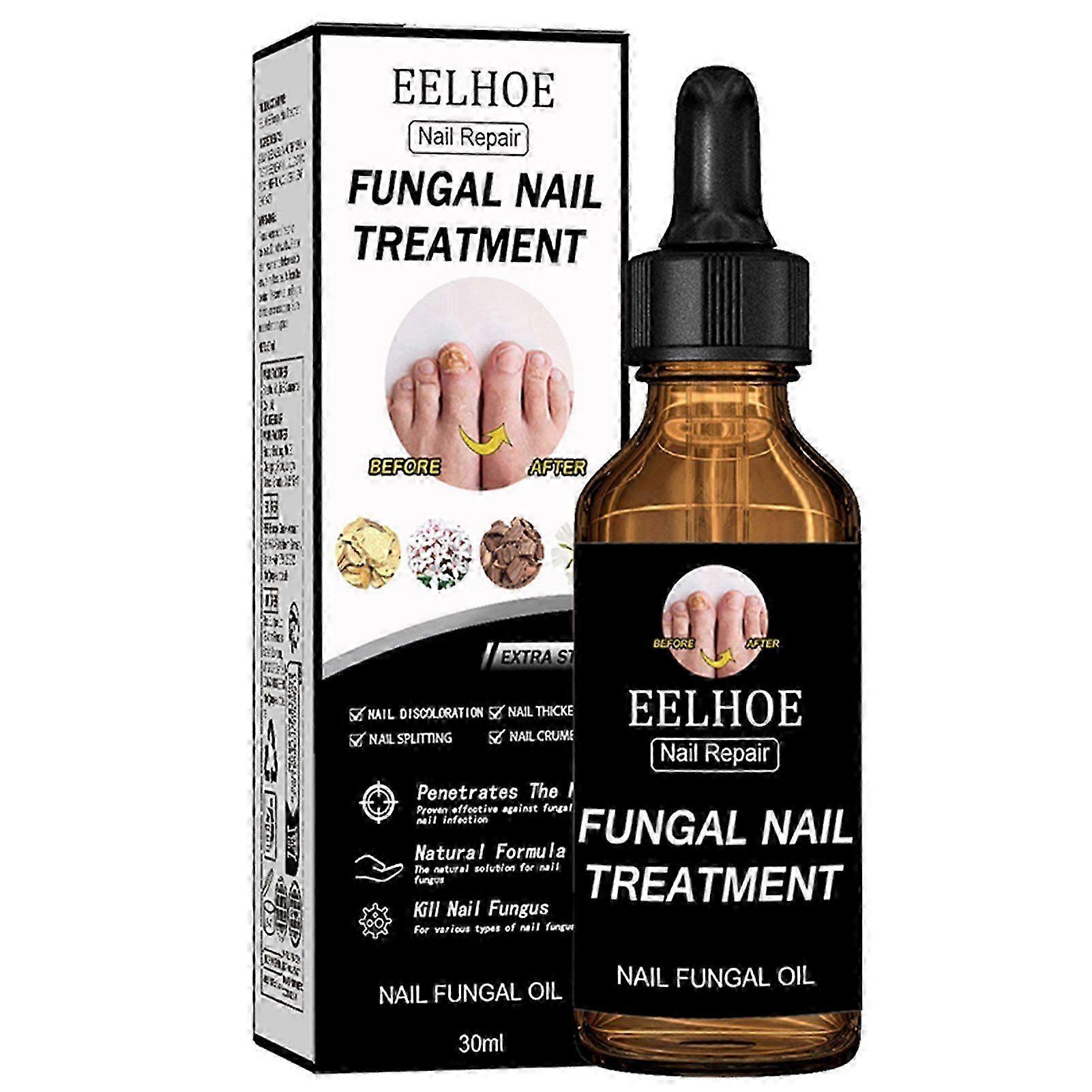 שמן לטיפול בציפורניים פטרייתיות, סרום לחיזוק ציפורניים, טיפוח ציפורניים, תיקון ציפורניים לציפורניים פטרייתיות ושבירות