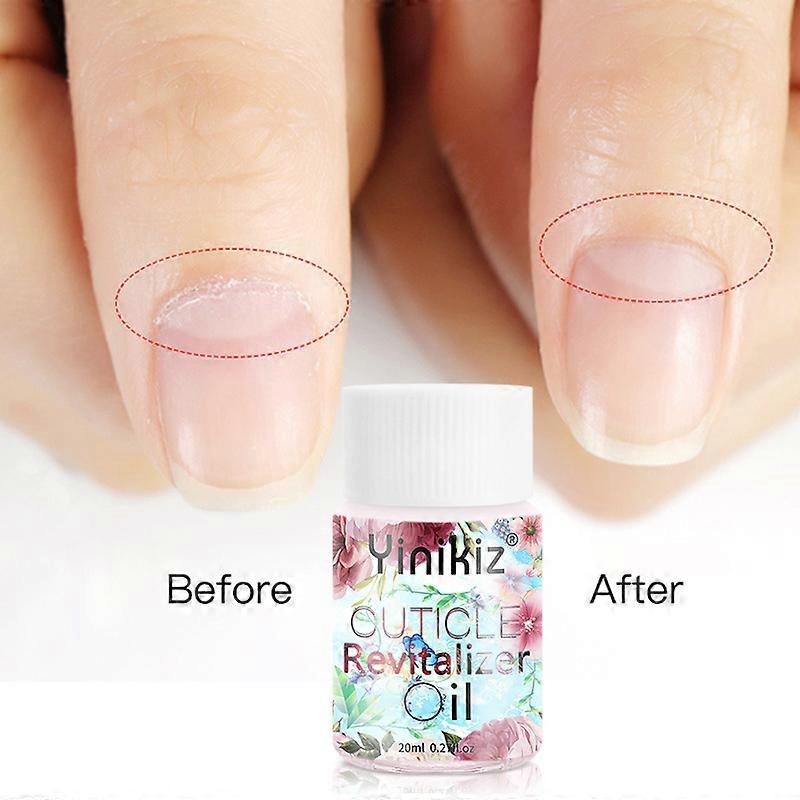 20 ml olejku odżywczego do skórek, zdobienia paznokci, olejek do pielęgnacji krawędzi paznokci, olejek do pielęgnacji krawędzi paznokci, produkty do zdobienia paznokci przeciw zadziorom 1