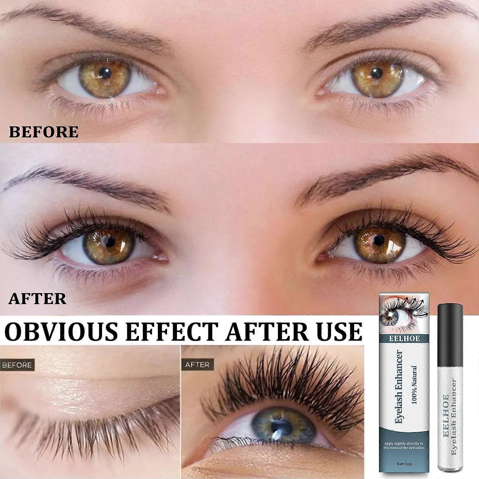 Eyelash Growth Solutions For Growing Thick & Long Eyelash Anti eyelash Shedding Sparse Eyelash